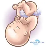 bebe