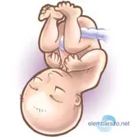 bebe
