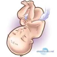 bebe