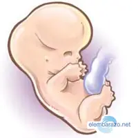 bebe