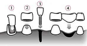 ¿Por qué conviene ir al dentista?