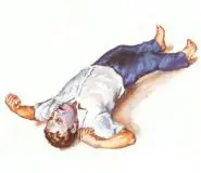Convulsiones -