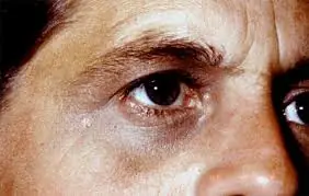 Sarna, queloide, vitiligo, y otras enfermedades de la piel