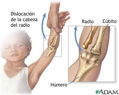 lesiones