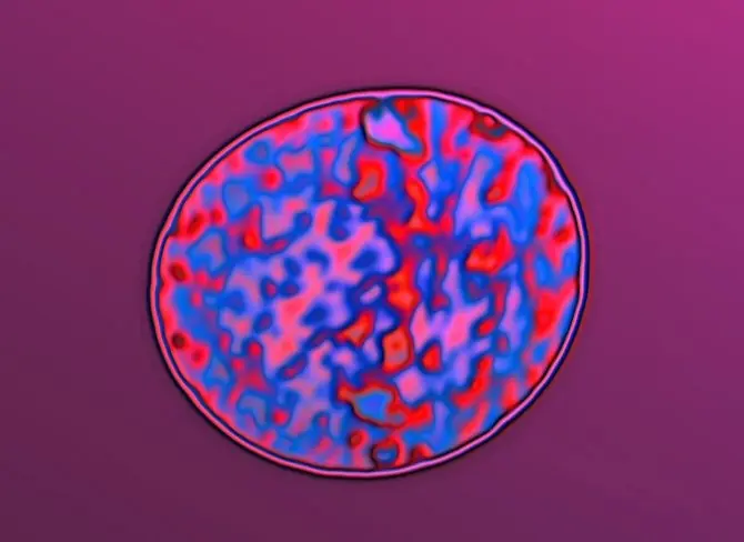 Nueva tecnica de detección de cancer