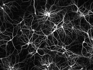 Alzheimer Se Propaga Por Circuitos Neuronales: Estudio