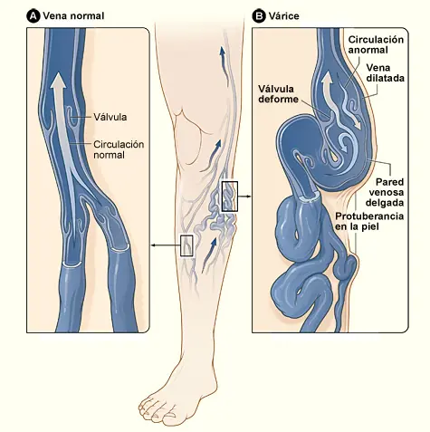 venas