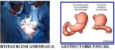 tratamiento