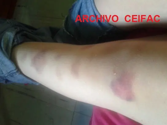 Fenómeno Polstergeist Antofagasta Chile CEIFAC