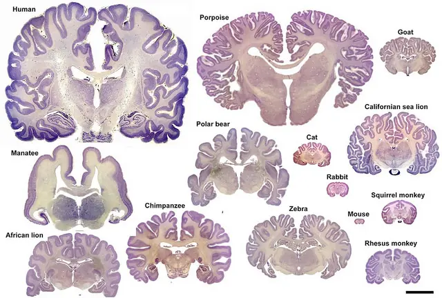 cerebro