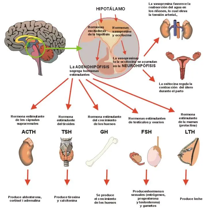 Información:¿Por qué nos duele la cabeza? - Explicación