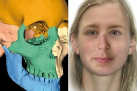 otzi