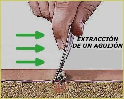 abejas