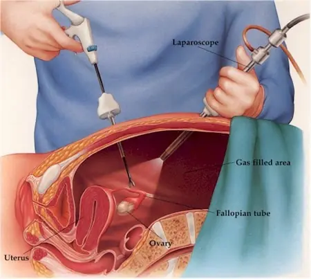 medicina
