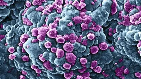 Mezcla de dos nuevas moléculas logra frenar cáncer de ovar