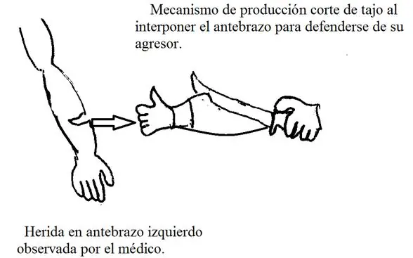 criminalística