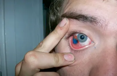 10 modificaciones corporales extremas
