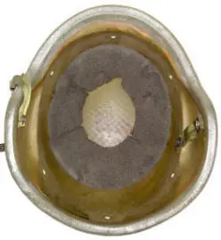 Casco
