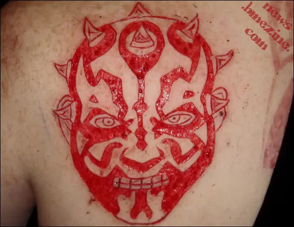 Cicatriz