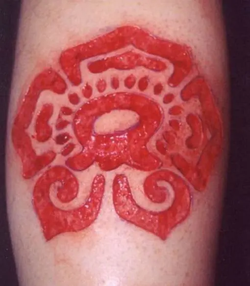 Cicatriz