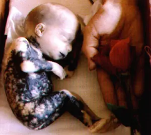 Sabes lo que es un aborto?[Impactante]