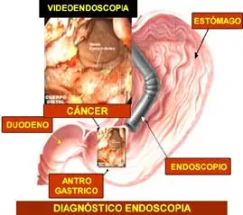 info