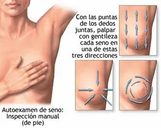 Todo sobre el cancer,Parte 2 ¡¡