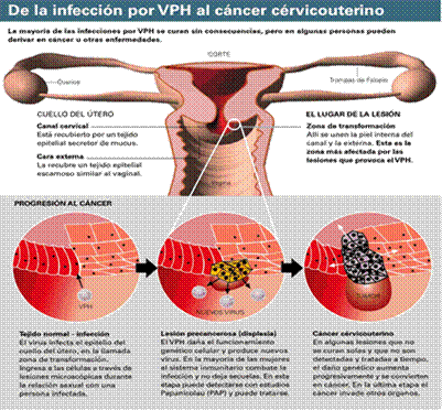 cancer