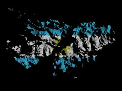 La triste historia de una veterana de malvinas