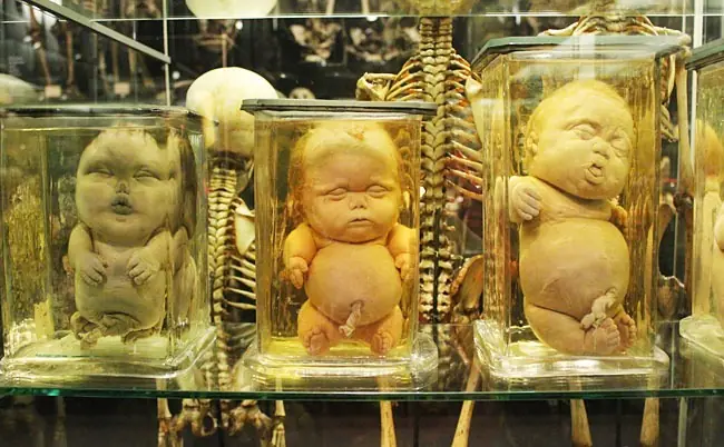 7 museos extraños en Amsterdam.