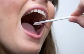 Hisopado bucal en una Prueba de ADN