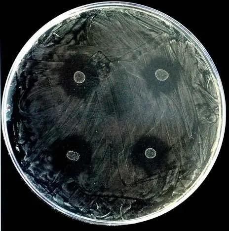 Chau dentistas: descubren una bacteria anticaries