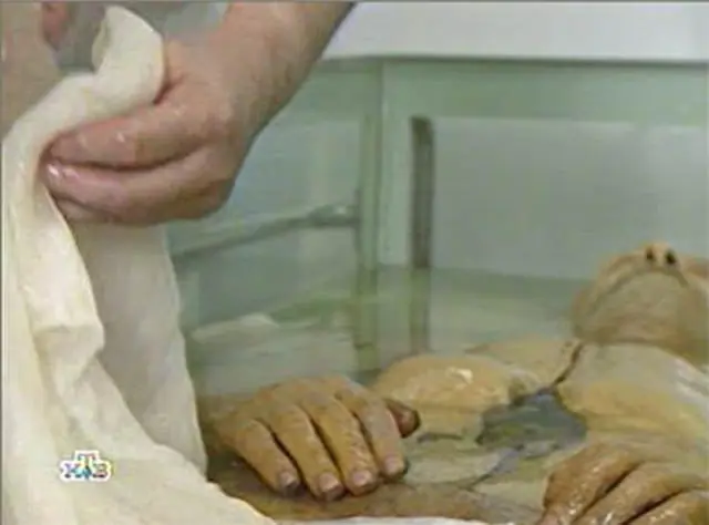 La higiene póstuma de Lenin