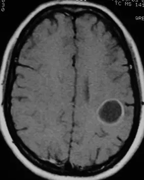 diagnostico
