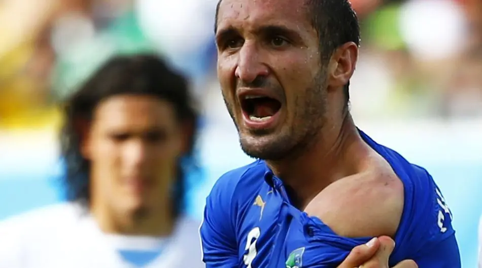 Mordida de Luis Suarez