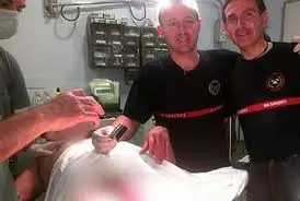 Le queda atrapado el pene en un tubo de acero