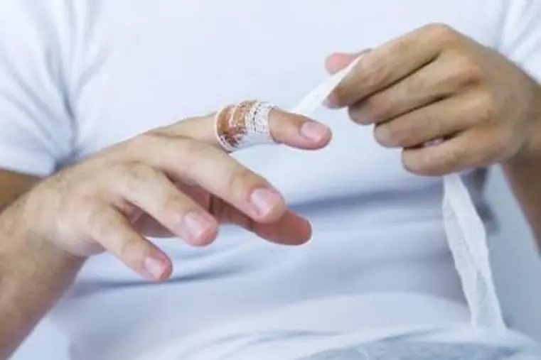 Primeros auxilios: ocho remedios que no funcionan