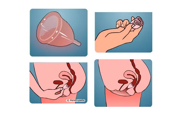 Tampon