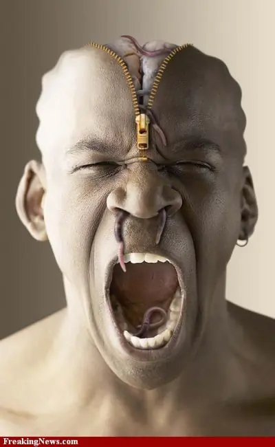 dolor de cabeza