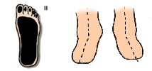 del