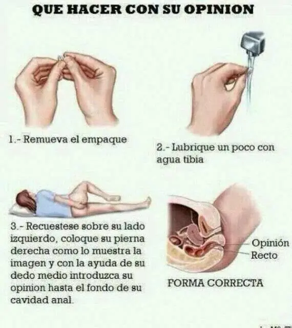 Las 3 clases de "opiniones"