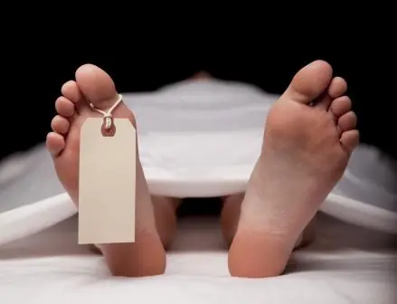 Las reacciones del cuerpo humano después de la muerte