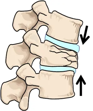 lesion de neymar