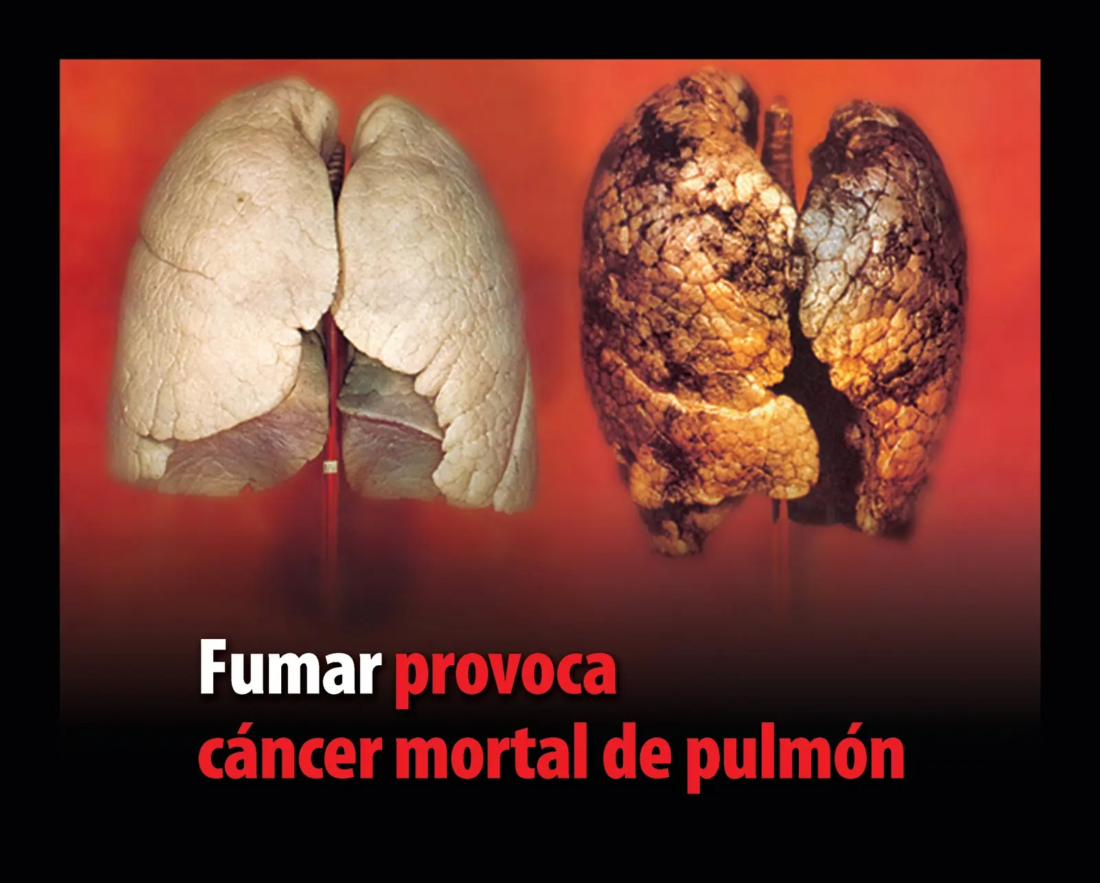 cigarrillos  cigarro