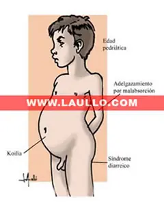 info