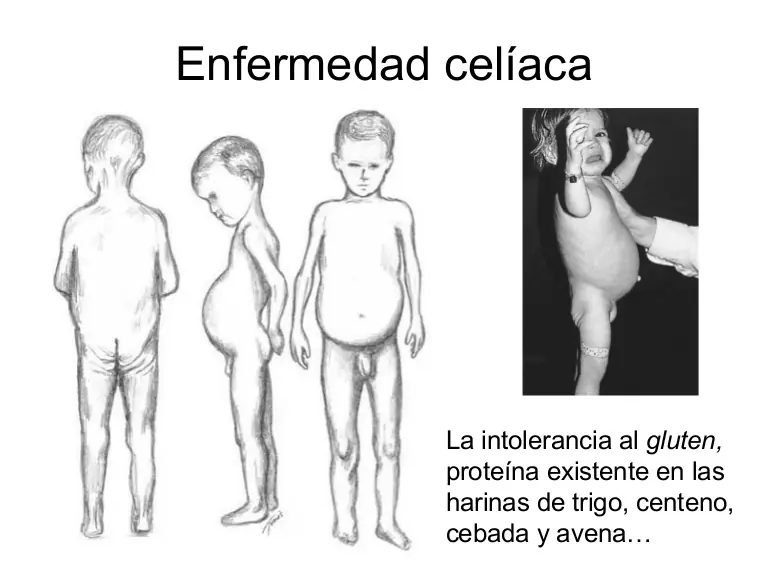 imagenes