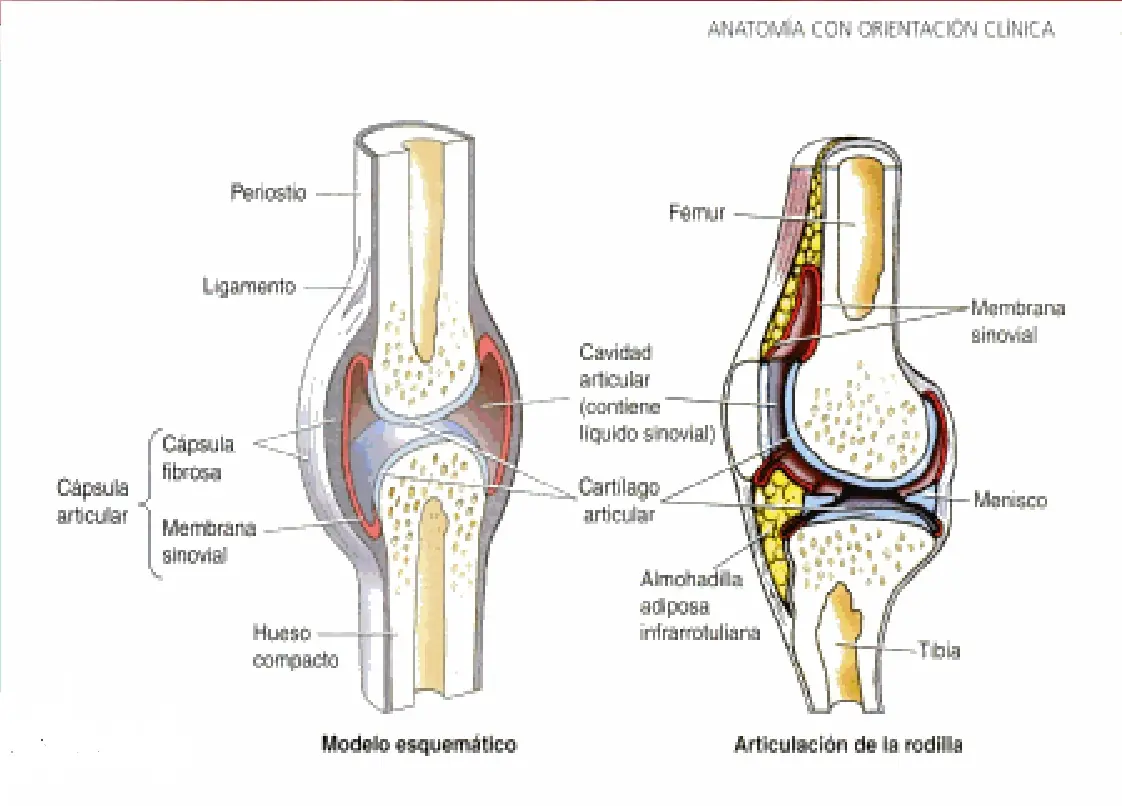 artritis