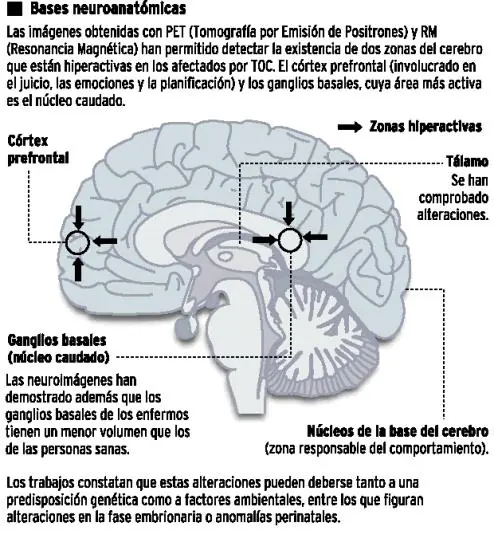 compulsivo.