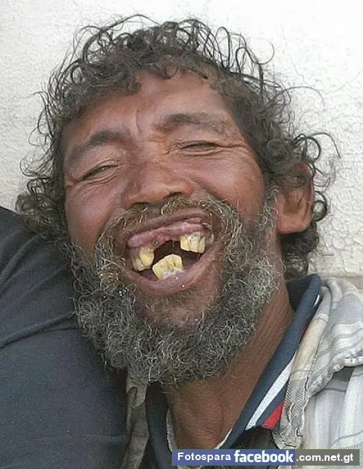 gracioso