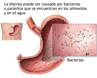 bacteria
